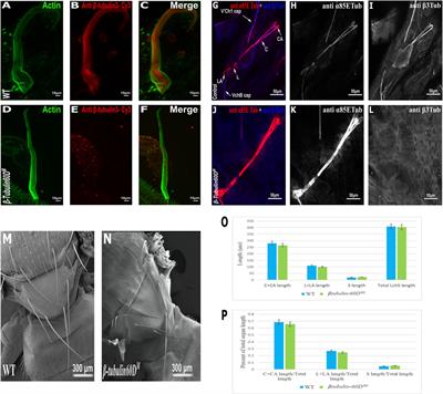 Revisiting the Role of ß-Tubulin in Drosophila Development: β-tubulin60D is not an Essential Gene, and its Novel Pin1 Allele has a Tissue-Specific Dominant-Negative Impact